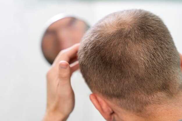 Benefits for Hair Loss