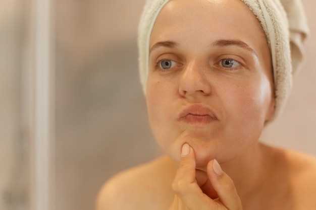 Key Benefits of Spironolactone for Acne Treatment: