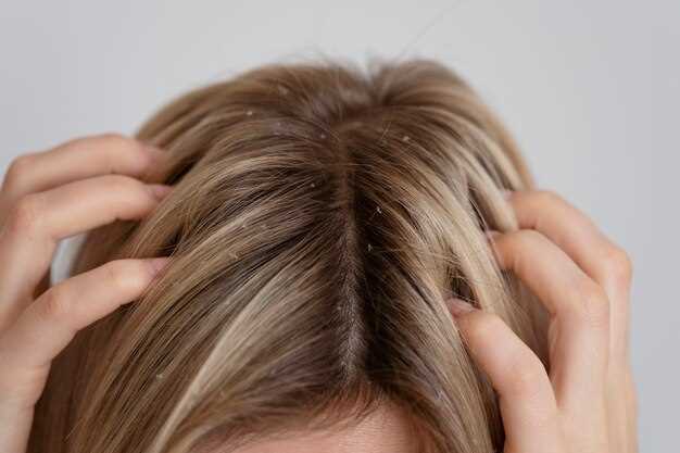 Causes of Hair Loss