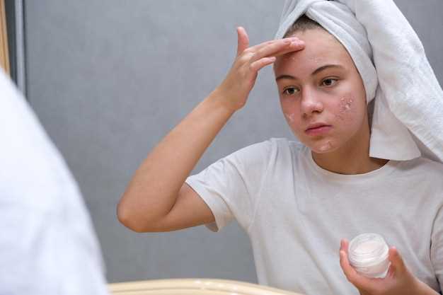 How long for spironolactone to clear acne