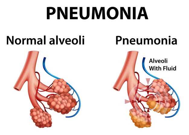 Spironolactone adrenal hyperplasia