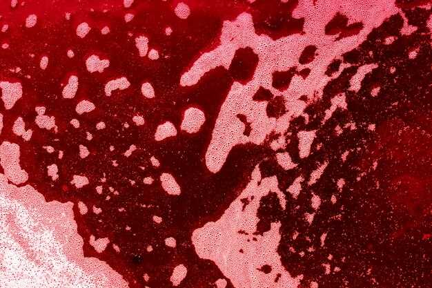 Spironolactone and gi bleed