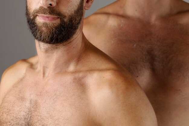 Spironolactone and gynecomastia