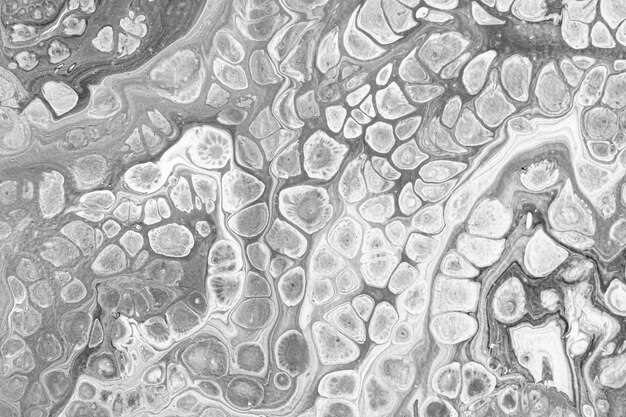 Spironolactone and stroke