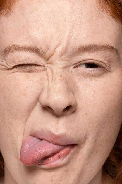 Spironolactone and wrinkles