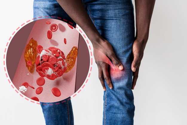 Spironolactone kidney stones