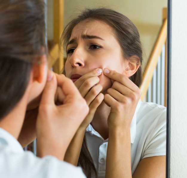 Topical spironolactone acne buy